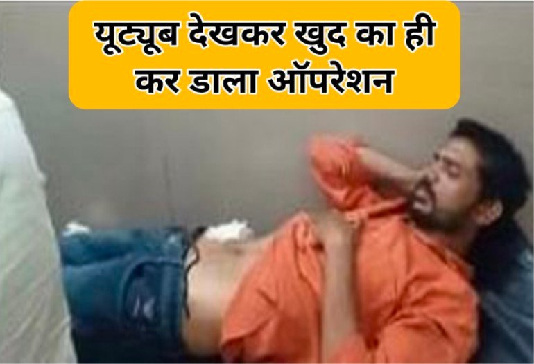 यूट्यूब से सीखा ऑपरेशन : यूट्यूब देखकर खुद का ही कर डाला ऑपरेशन, हालत बिगड़ी तो अस्पताल पहुंचा युवक